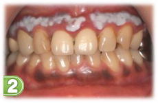 �K���s�[�����O�Q