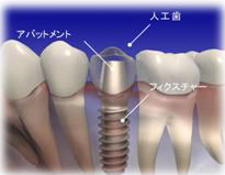 �C���v�����g�摜