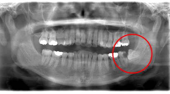 �e�m�炸�摜�P