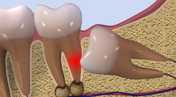 �e�m�炸�摜�Q