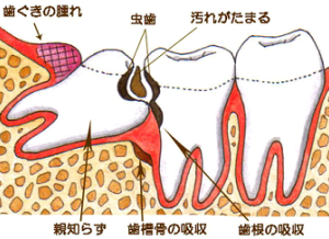 �e�m�炸�摜