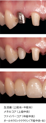 �R�A�̔�r�摜