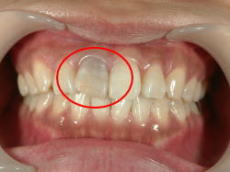 �E�H�[�L���O�u���[�`�O